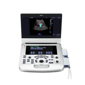 ECOGRAFO ACCLARIX EDAN AX3 + 2 TRANSDUCTORES